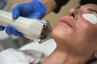 halo skin resurfacing treatment