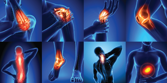 Which medication is the most effective for joint pain?