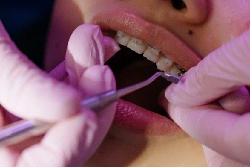 Tips for Finding the Best Orthodontist Near Me